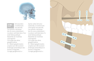 implants maxillofaciaux