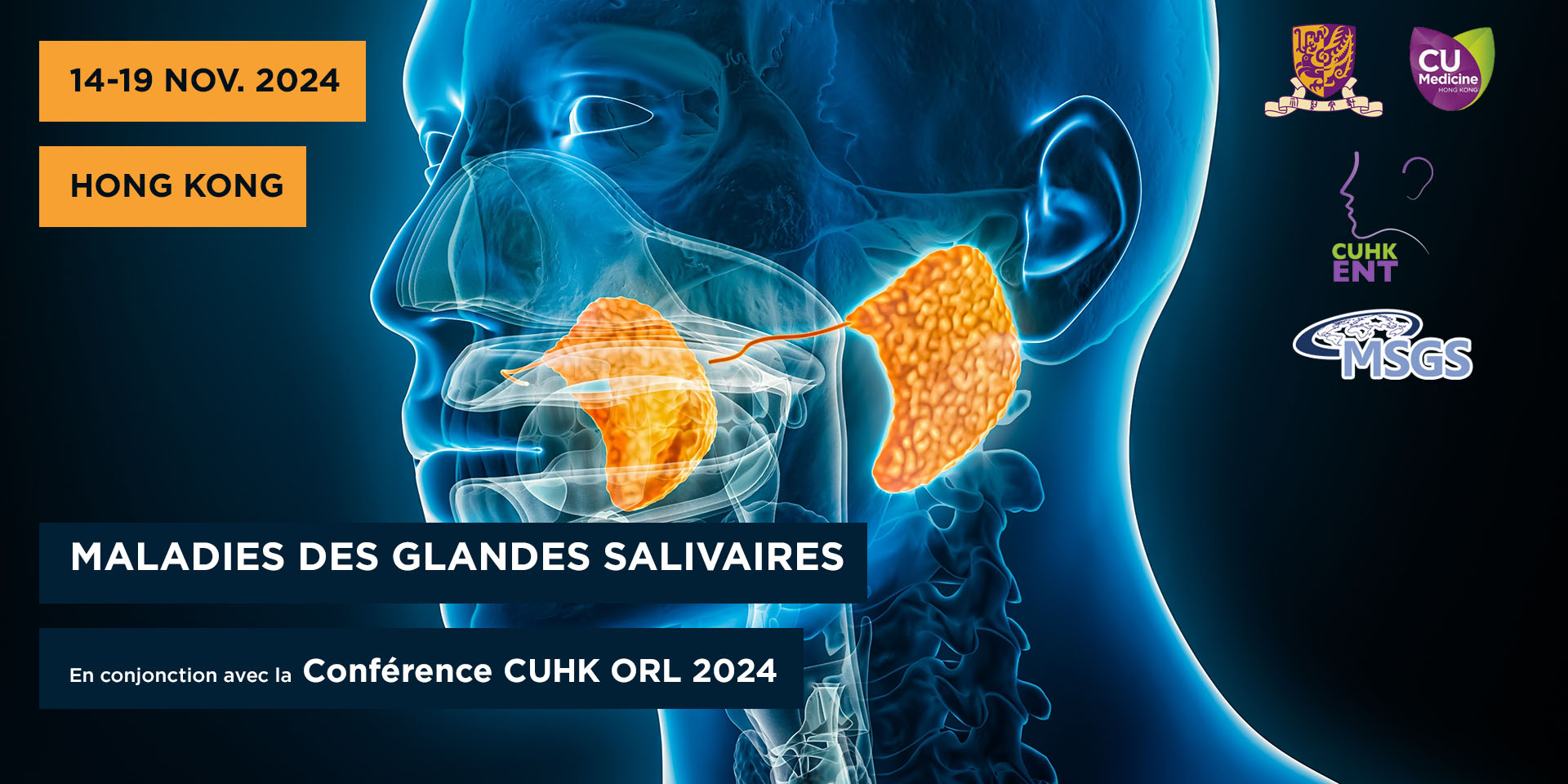 maladies des glandes salivaires